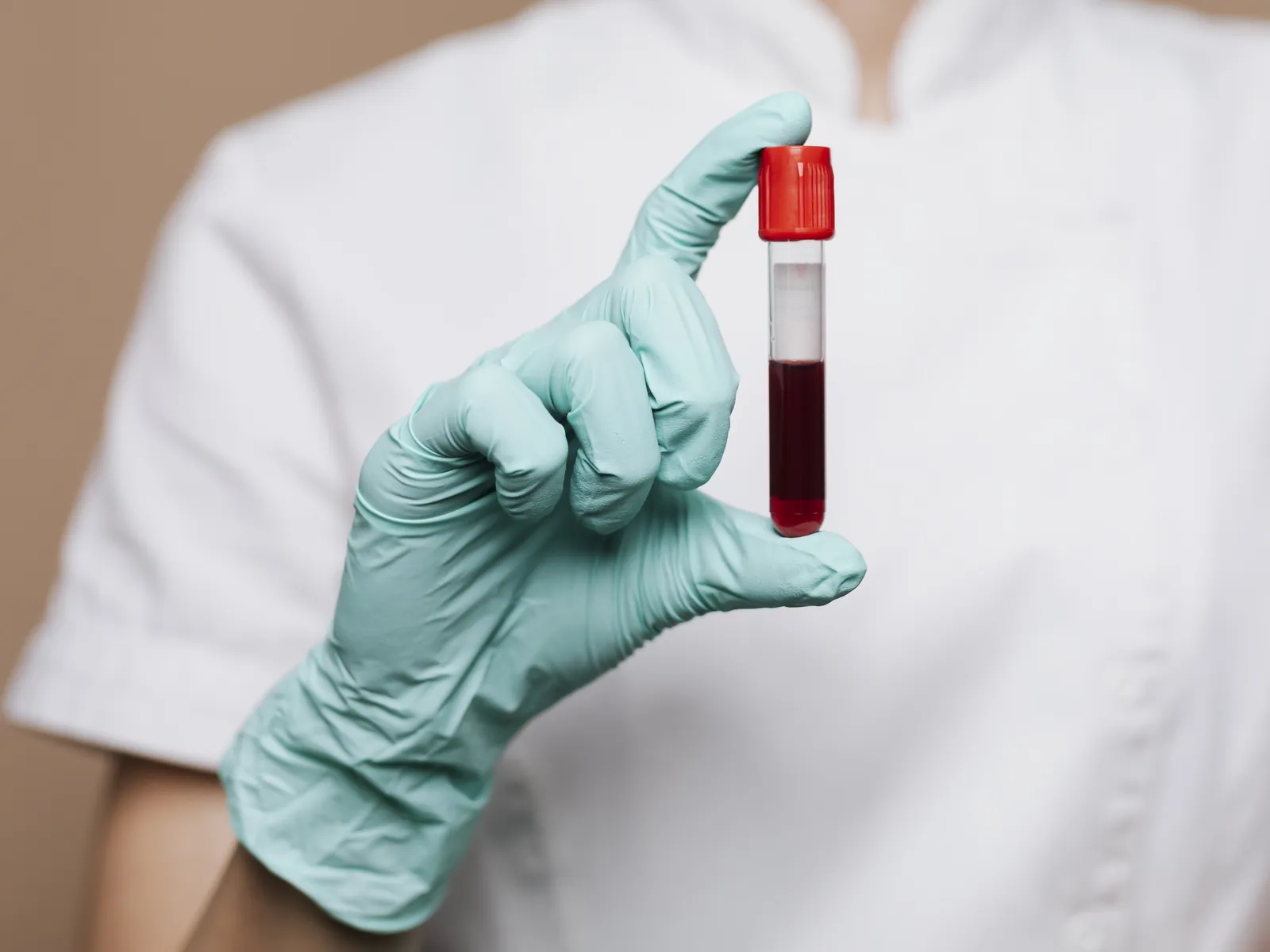 Pre-Procedure Tests