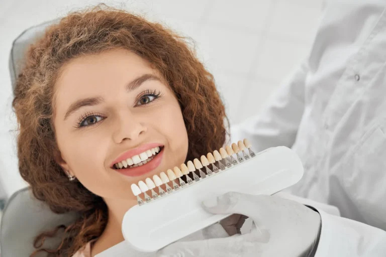Dentist matching tooth colour with a shade guide for veneers